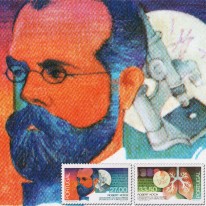 Gruźlica Płuca Robert Koch